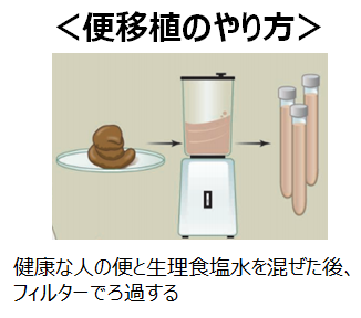 便移植のやり方：うんちの準備